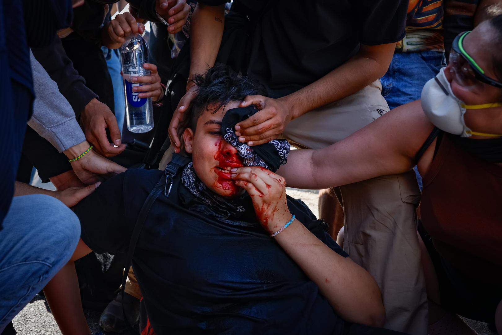 Los Angeles, CA - June 08: A protester is hurt near the 101 Freeway as clashes with law enforcement in downtown Los Angeles due to the immigration raids in L.A. grows on Sunday, June 8, 2025 in Los Angeles, CA. (Jason Armond / Los Angeles Times via Getty Images)