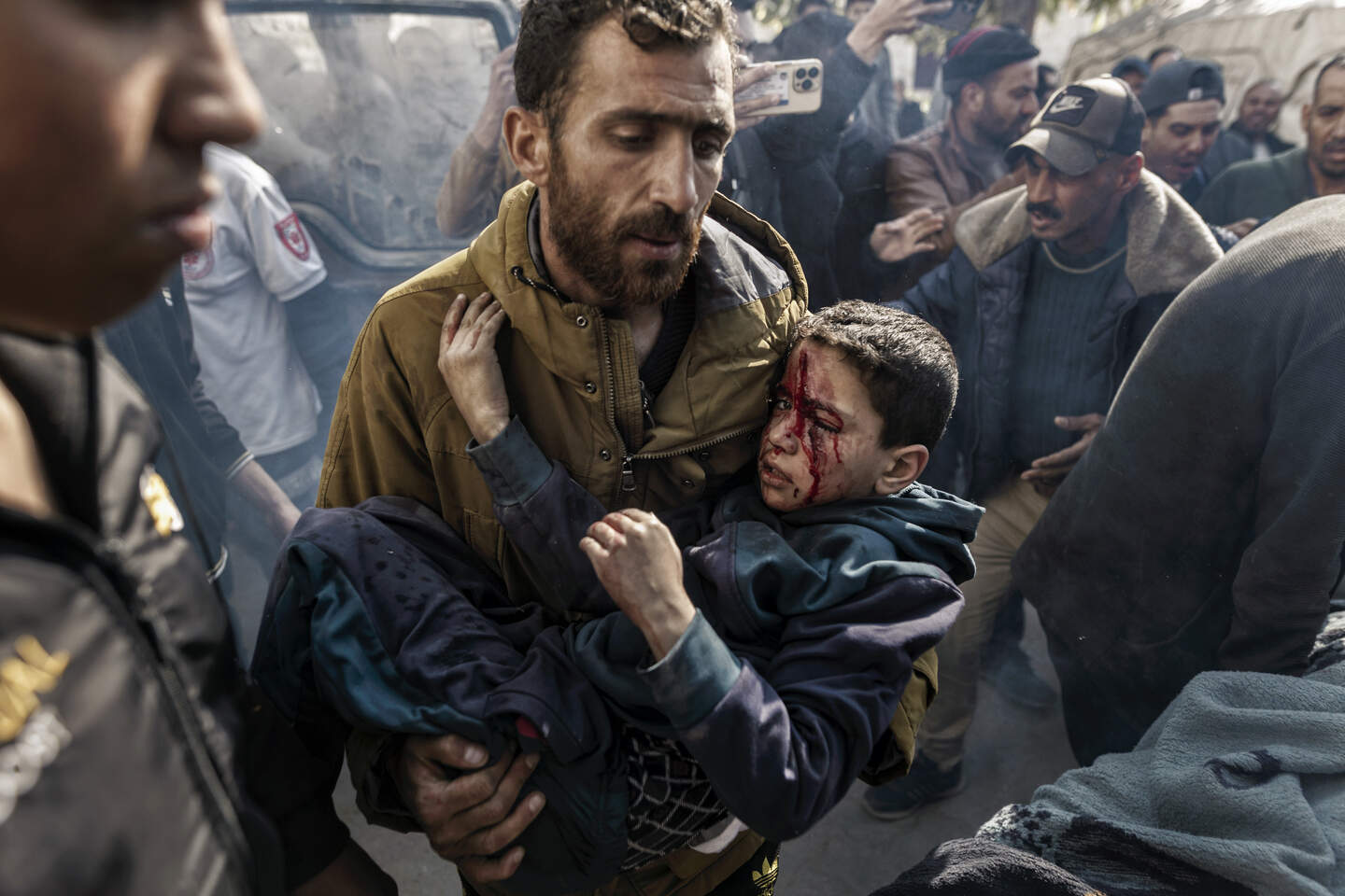 FILE — A child wounded in a strike in central Gaza is transferred to the Arab Baptist Hospital in Gaza City, April 12, 2025. Saher Alghorra won the 2026 Pulitzer Prize in breaking news photography, for documenting the toll of Israel’s attacks in Gaza. With international journalists barred from the territory without Israeli escorts, Alghorra, a Palestinian photographer, played a crucial role. (Saher Alghorra/The New York Times)