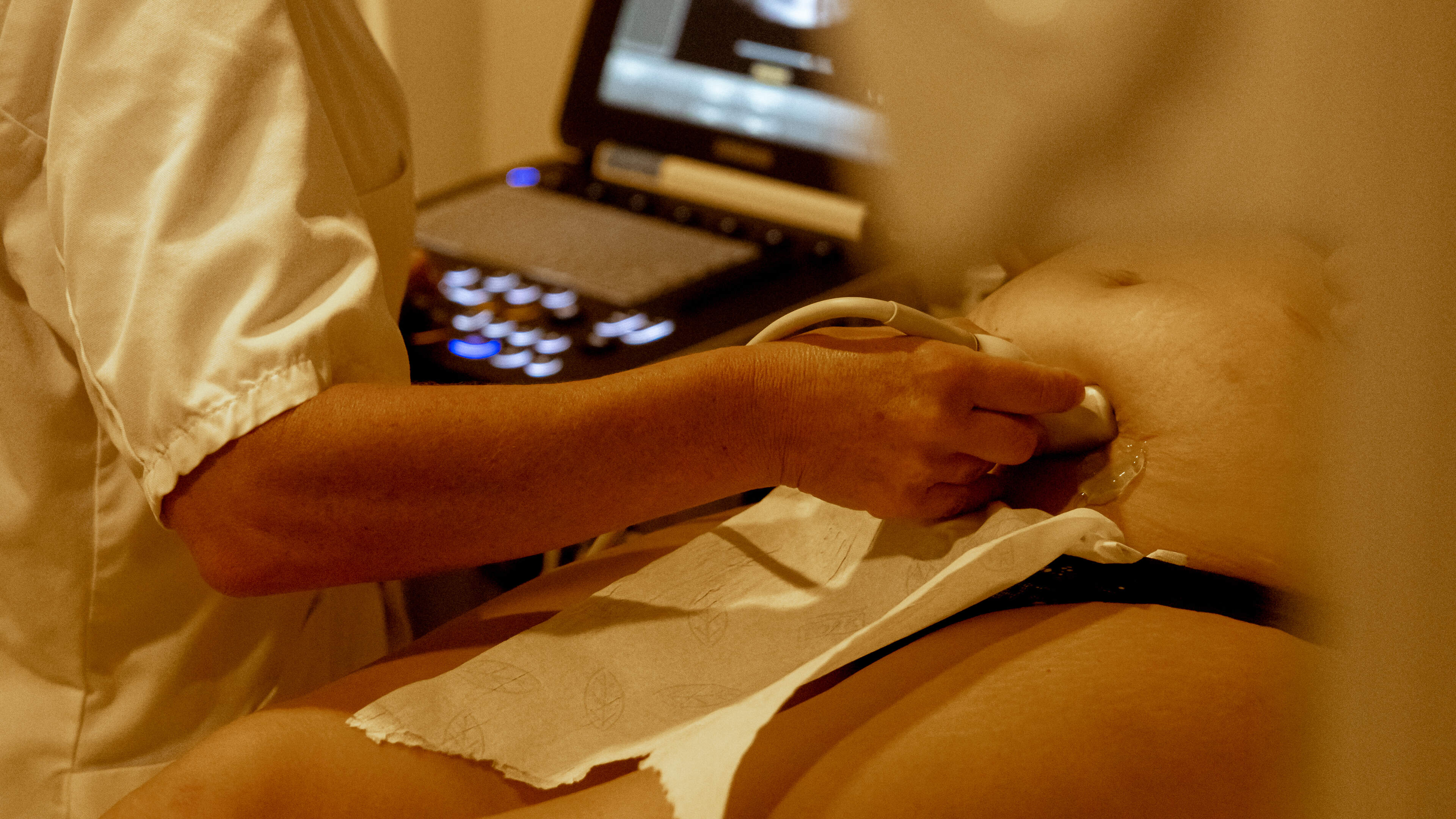 “Ook met meer preventie kun je nooit alle late abortussen vo